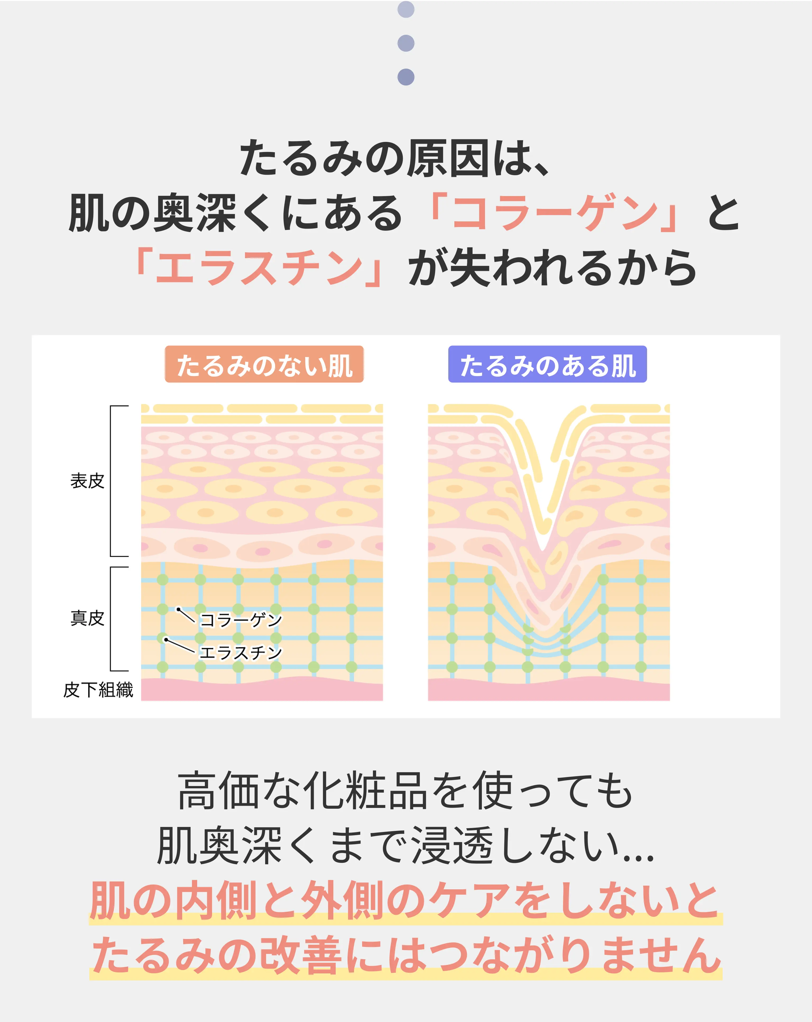 ニキビは皮脂のつまりに始まる 